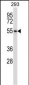 POLR3D Antibody (Center)